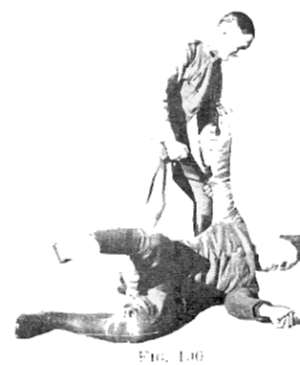 Fig 100
