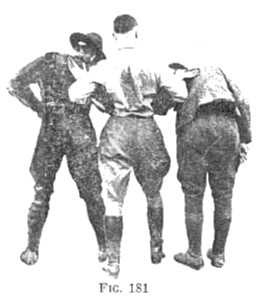 FIG 181